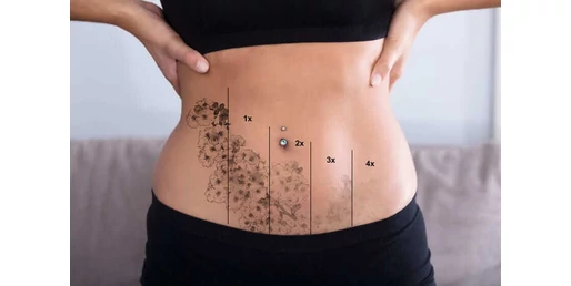 Ne bántsd szegény bélflórádat!