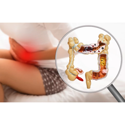 8 alattomos jel, ami rossz bélrendszerre utal