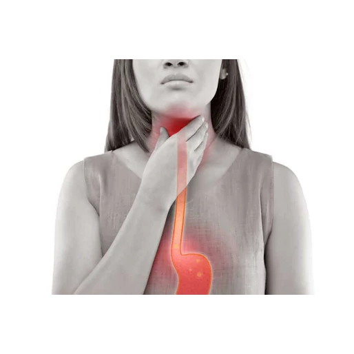 Mi az a reflux, és hogyan befolyásolja a bélflóra?