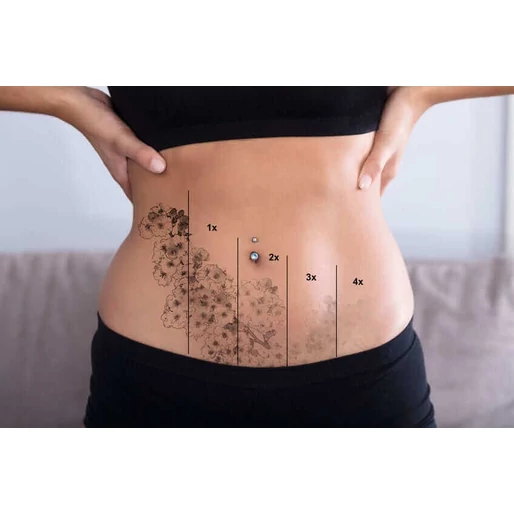 Ne bántsd szegény bélflórádat!