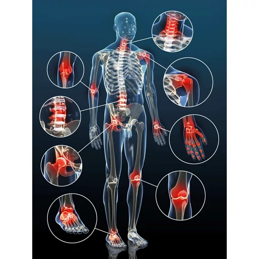 Gyulladások a szervezetben - Amit mindenképp tudni kell róluk: