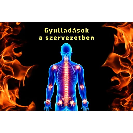 Gyulladások a szervezetben - Mit kell tudni róluk?